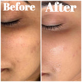 Hinza glow before and after results